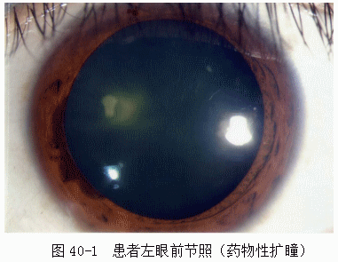 ZY016_218_1.gif